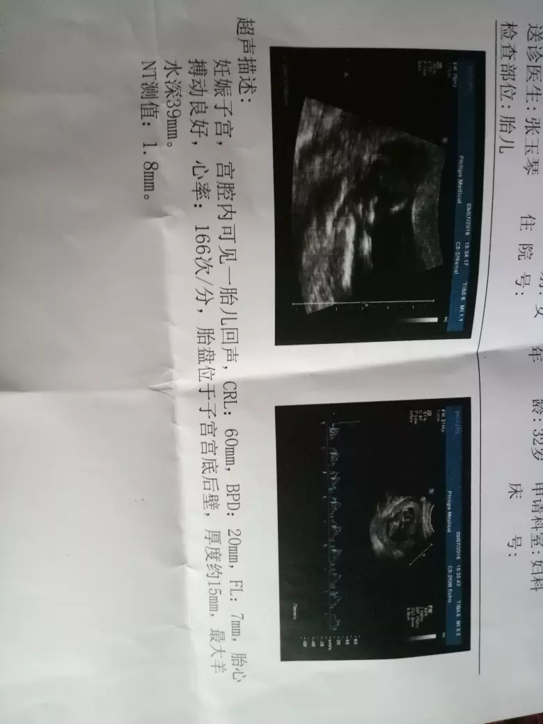 懷孕多長時間能測出來男女孩：懷孕多長時間能查出是男孩還是女孩？