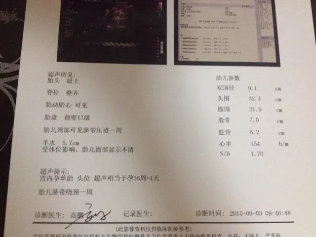 最准懷女孩徵兆有哪些：九個最准懷女孩胎夢