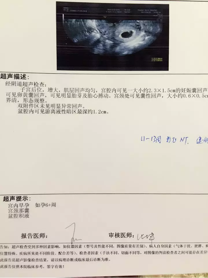 懷孕6周胎兒圖片欣賞：懷孕最後6周胎兒能長多少斤？