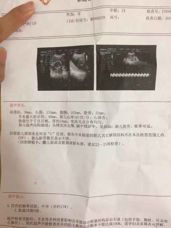 怎樣判斷懷男懷女最準確：九個最准懷男孩胎夢