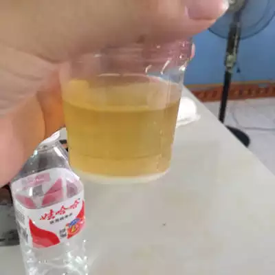 懷孕尿里加蘇打測男女：B超看男女準確率有多大？