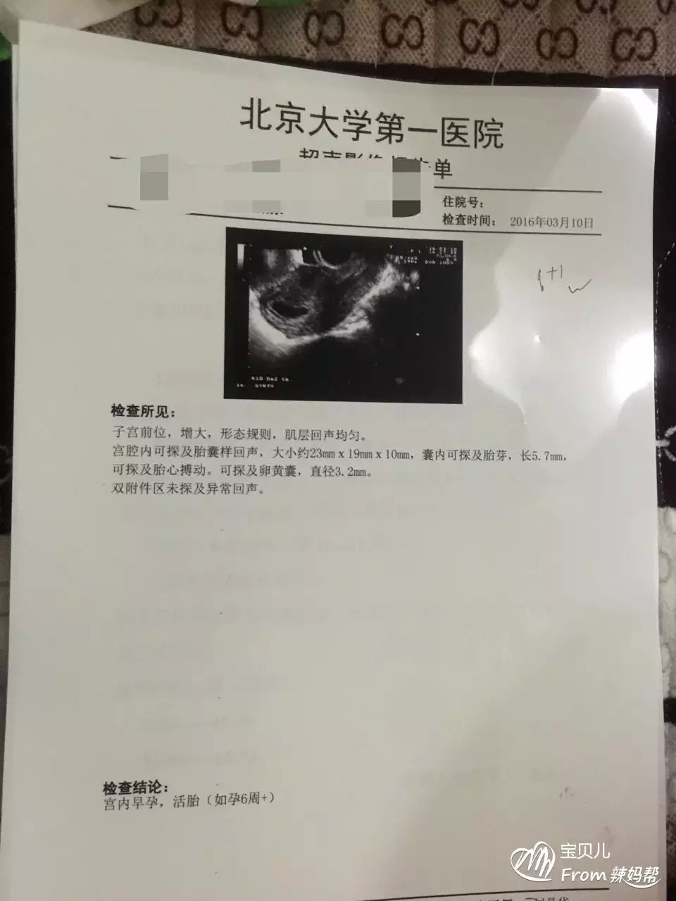 5、10秒測出懷男孩和女孩:怎樣可以檢測懷男孩女孩