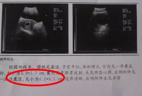 怎麼看懷男孩女孩最準確的：怎麼看孕婦懷的是男孩還是女孩最准