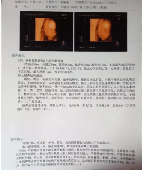 b超圖特點男孩：男孩B超圖是什麼樣的