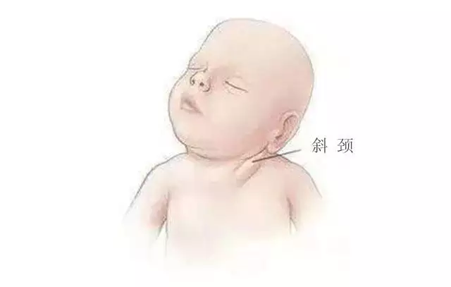 2、人一出生就一歲了嗎:是不是人一出生就算一歲