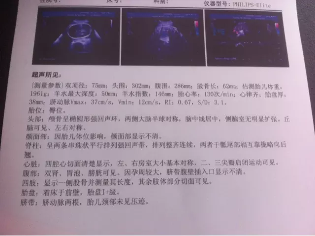 雙頂徑約股骨長約頭圍約.5mm圍約大概有多重不知道男女37加6？