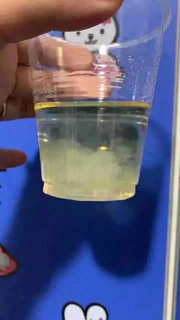 小蘇打測男女我的准了：喜脈怎麼判斷是男女