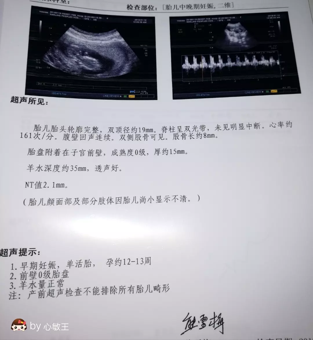 醫學認為懷男孩最准特徵：懷男孩最準的特徵是什麼