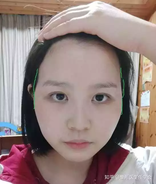 2、女人太陽凹陷的人命苦嗎:額頭窄太陽凹陷命不好