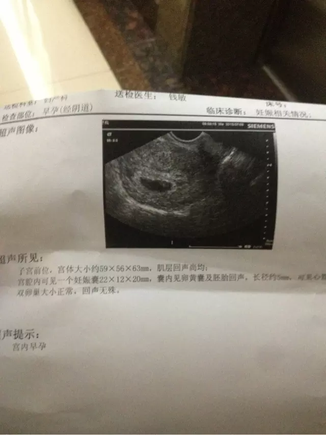 懷孕初期測男女土方法：想要知道,最簡單的土方法測男女是什麼？