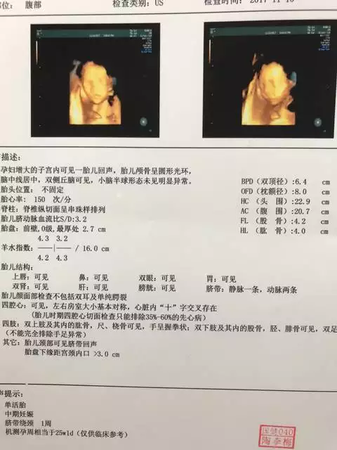 已生男孩的四維彩超圖：七個月四維彩超圖片，看下是男孩女孩？