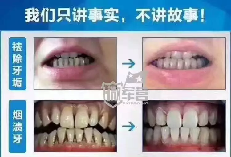 1、下牙掉了代表什麼親人:做夢夢到下牙掉了！是什麼意思？