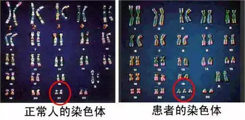查費用大概多少錢：做檢查費用多少？