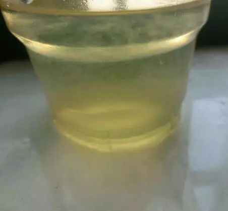 孕婦的晨尿是什麼顏色：早孕初期，晨尿顏色是不是會加深，比較黃