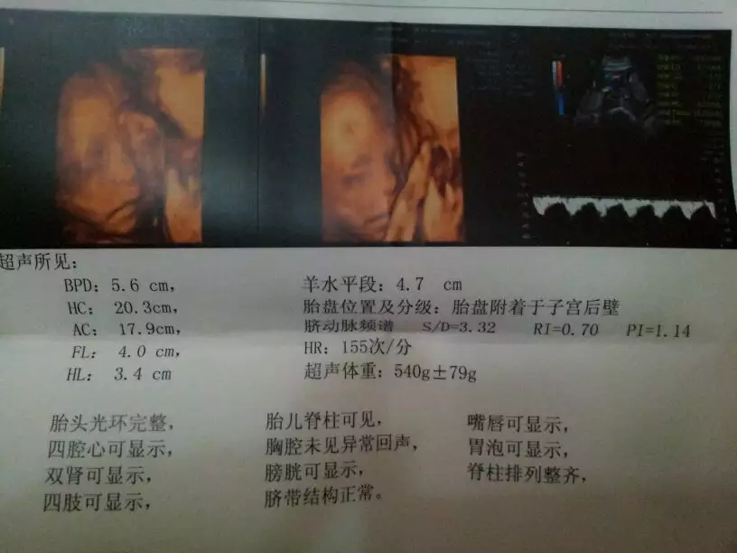 懷孕幾個月能看出男女最清楚：四個月零两天做b超准嗎怎麼看的出男孩女孩呀