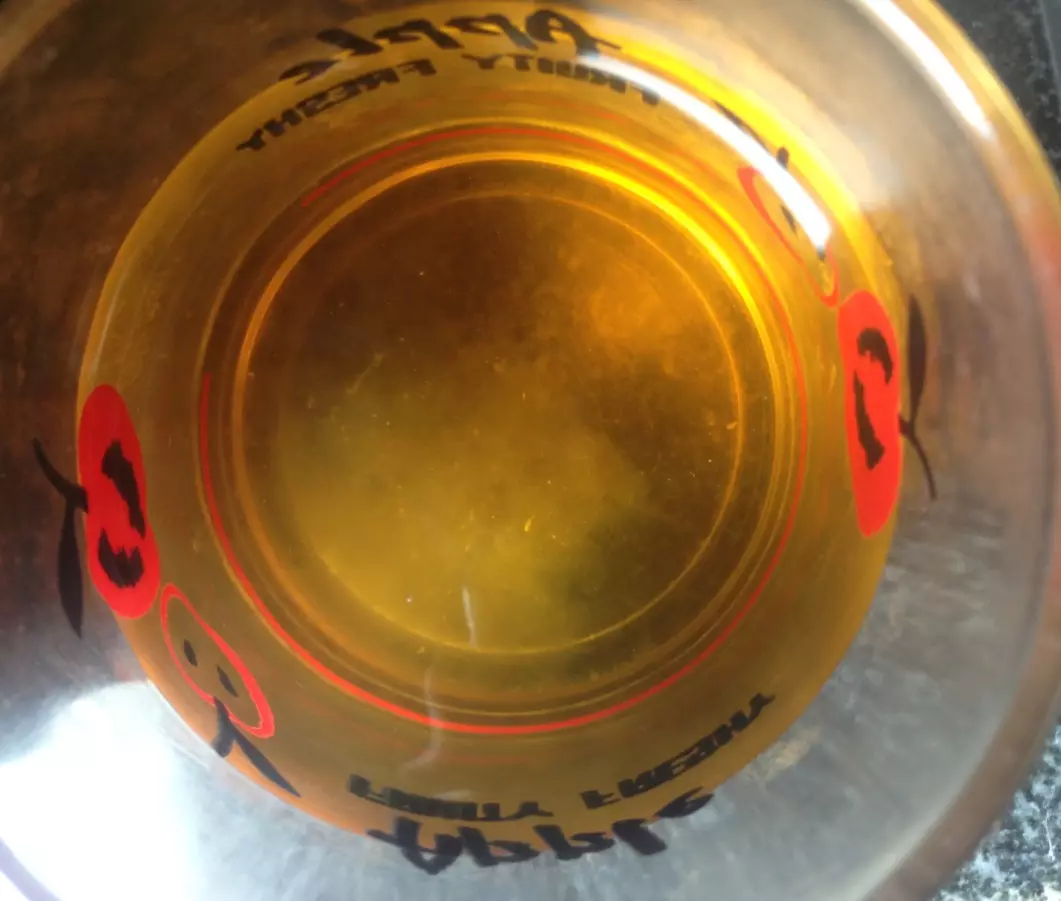 早上里有棉絮一樣的東西：為什麼中會棉絮樣的沉澱物