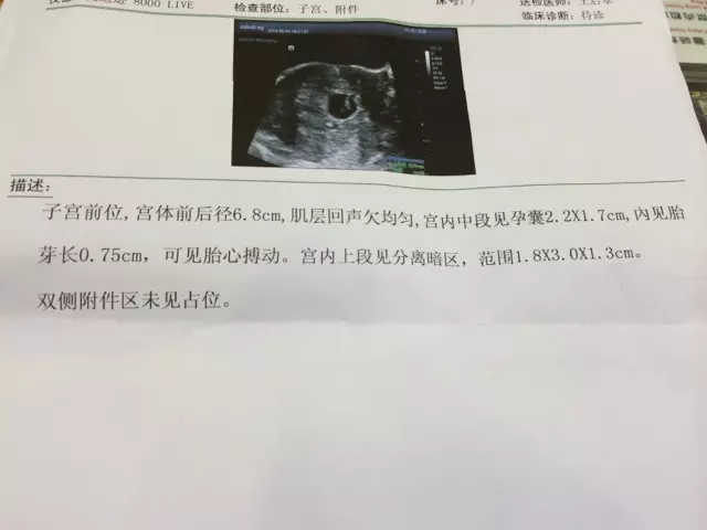 4、懷孕45天抽血查准嗎:驗血有沒有可能驗不出來已經懷孕了？