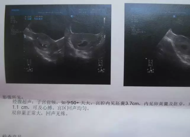 1、正常情況下一次大概幾分鐘:男生正常一次是幾分鐘