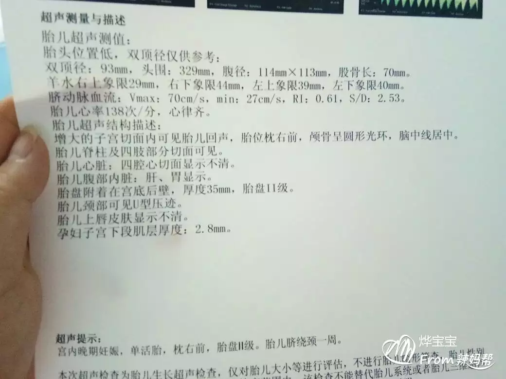 三胎孕吐比前兩個還厲害：懷兒子的特徵最準的
