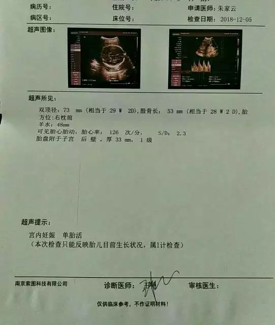 懷孕12周胎心率多少才正常呢？是不是從胎心...