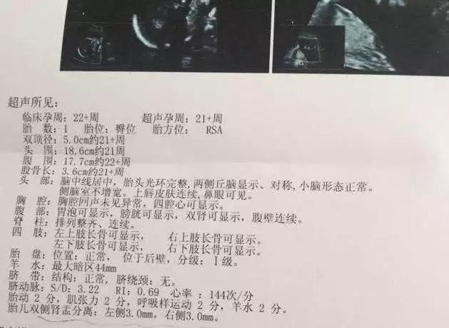 單雙月生男生女準確嗎：大家好，我想生個女孩，有人說單月生女孩雙月生男孩這是真的嗎