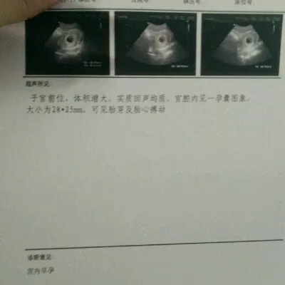 孕囊長的和圓的有什麼區別：孕囊是長形，還是圓形的
