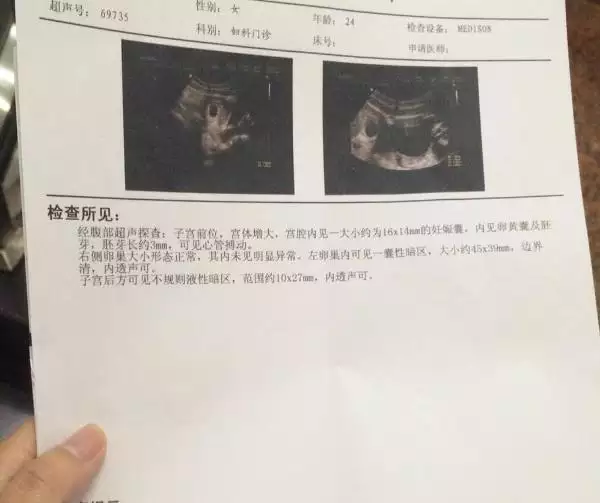 有沒有雙歲雙月懷男孩的，是周歲還是虛歲，如果周歲雙月是男孩還是女孩
