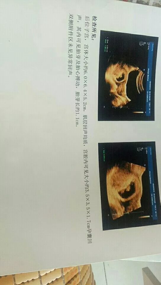 3、10秒測出懷男孩和女孩:懷男孩一定會比懷女孩早測出來嘛