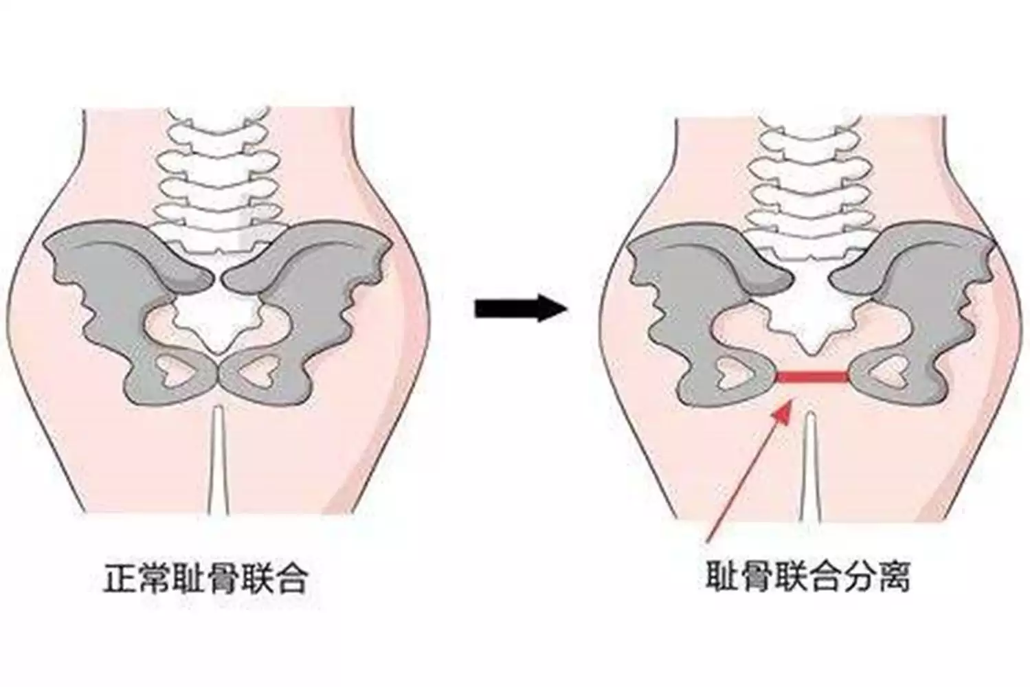 怎麼從八字看出來哪年適合懷孕：從生辰八字看你什麼時候能懷孕，生育是否有問題