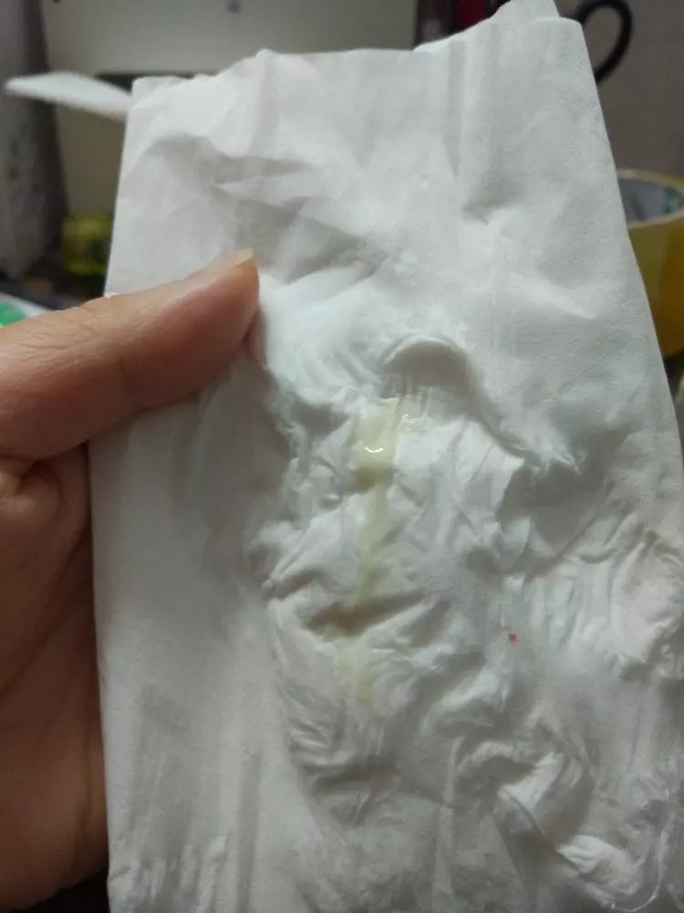 3、先排卵還是先白帶拉絲:白帶拉絲前排卵還是之後排卵。混亂。