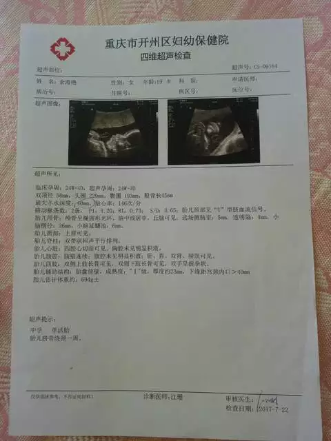 怎樣看懂四維彩超單是男是女：23十6天如何看四維彩超報告單看男女
