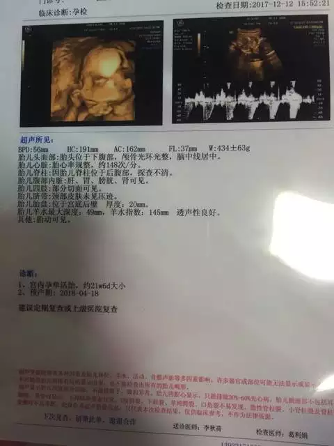 生男生女預測表農曆下半月來怎麼看清宮圖