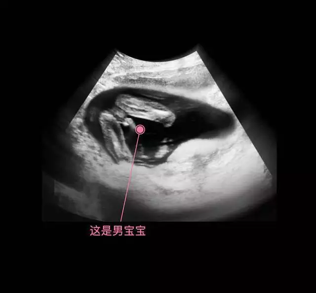 二胎一定懷男孩的方法如下：怎麼才能懷個男孩？ 在此求一下實用的方胎一直想要男孩