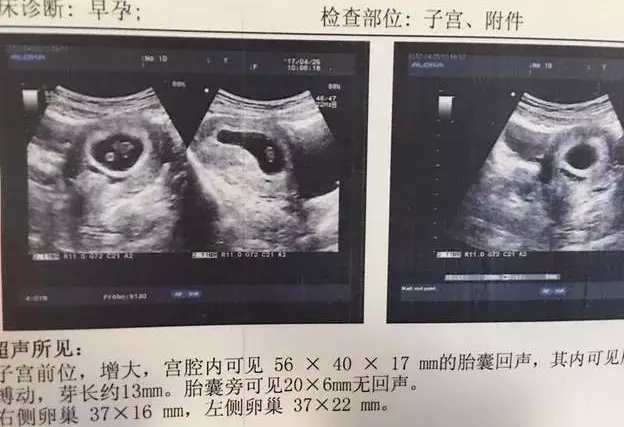 怎麼能看出來懷的是男孩女孩：怎麼看的出自己懷男孩還是女孩
