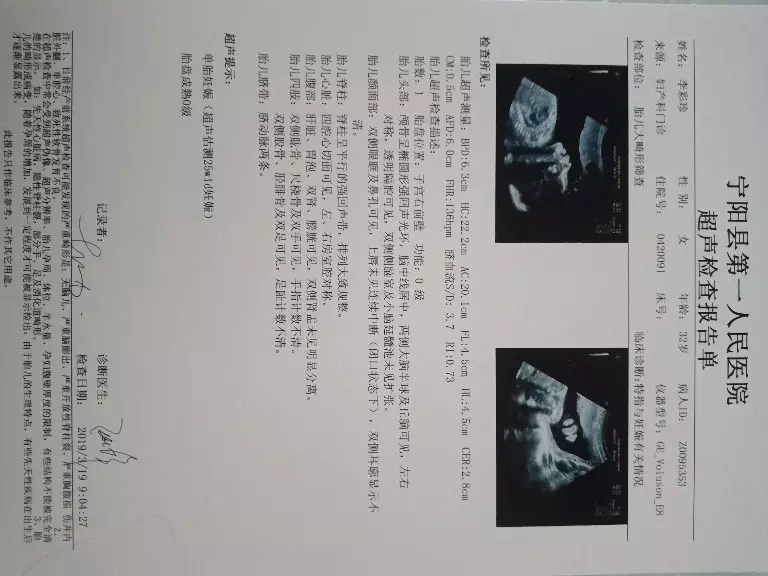 1、懷孕查男女查最准方法:有什麼最準確的方以辨別男女