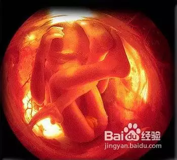 孕12周胎兒小雞彩超圖：男孩早是真的嗎，有寶媽一樣的嗎
