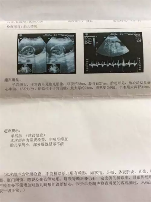 懷孕一個月怎麼查男孩女孩：一個月怎麼知道男孩還是女孩