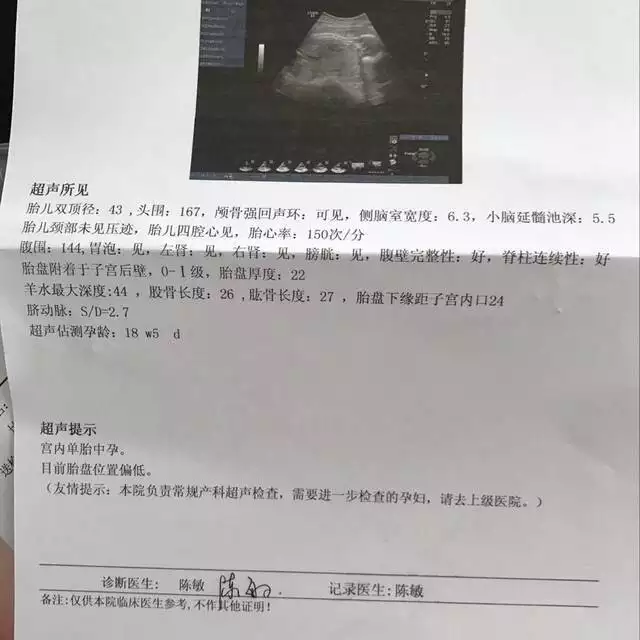 1986年正月份出生，本命年運勢如何，應注意什麼
