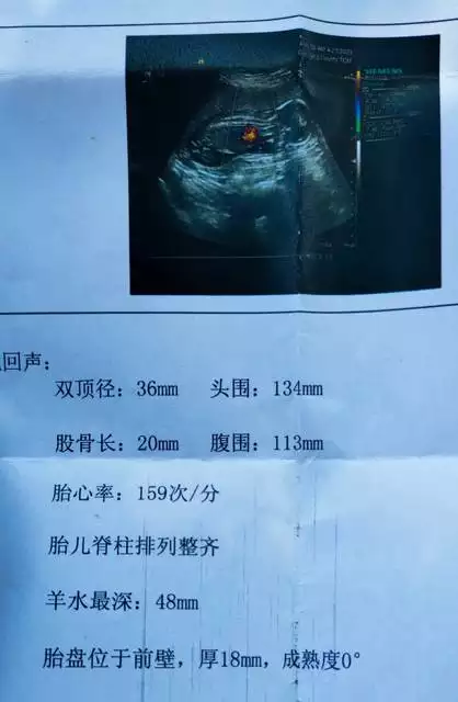 懷男孩的初期特徵最准心跳：懷兒子的特徵最準的