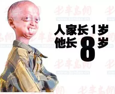 1、女同夥在要娶親的時刻，說自己的怙恃是近親娶親，我該怎麼處置這段情緒？