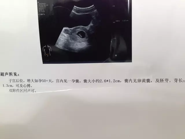 懷孕初期判斷男女最准方法：怎樣知道自己懷的是男孩還是女孩