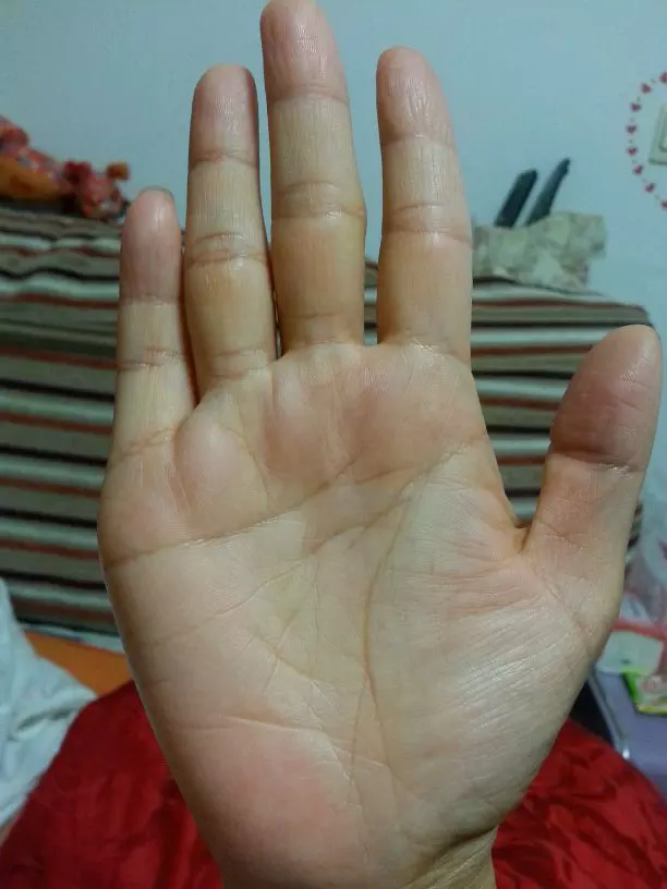 8、婚姻線斷了代表什麼:手相愛情線斷了是怎麼回事？