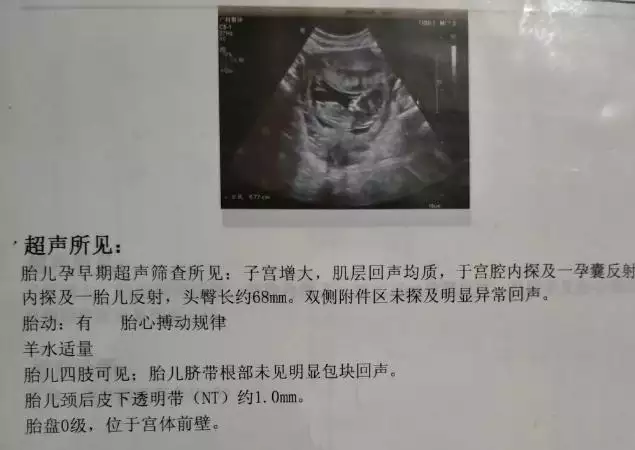 6一7周孕囊大小看男女B超圖：胎囊3個數據看男女公式哪裡可以找到？