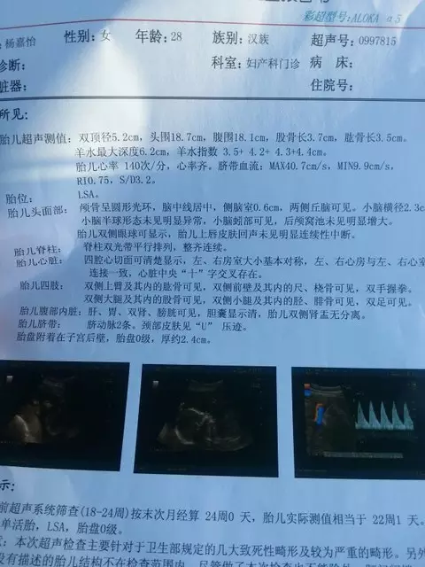 6、21,18,13三體看男女公式:21、18、13三體及數目表示什麼意思？