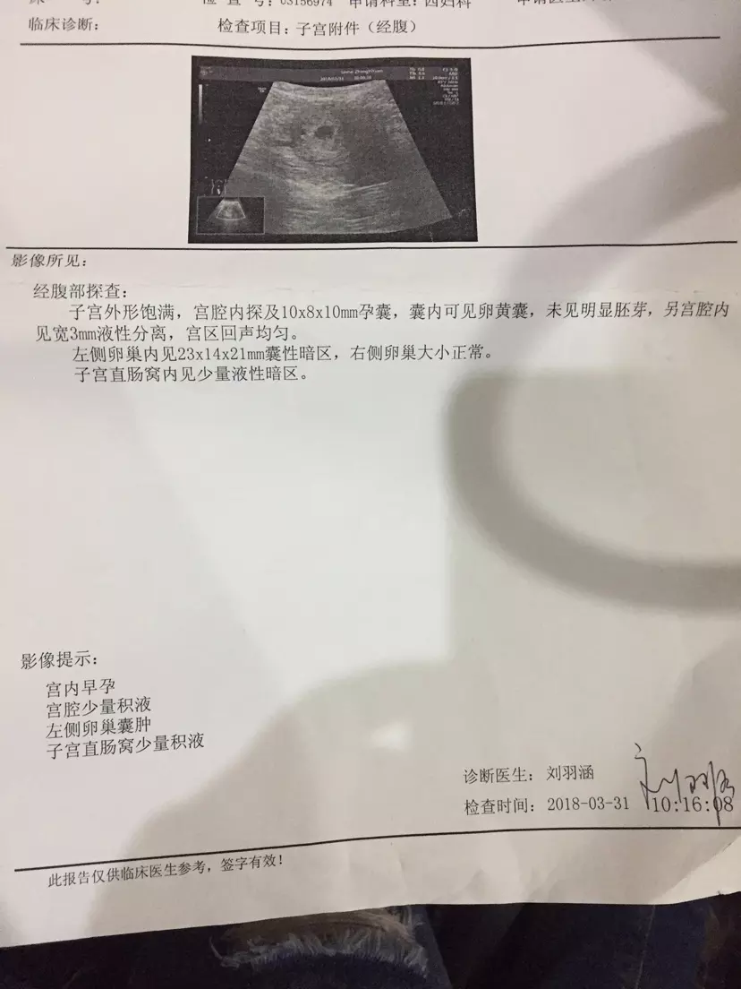 懷孕一個月看不到孕囊正常嗎：懷孕一個月今天照B超說看不到孕囊 請問一下怎麼回事