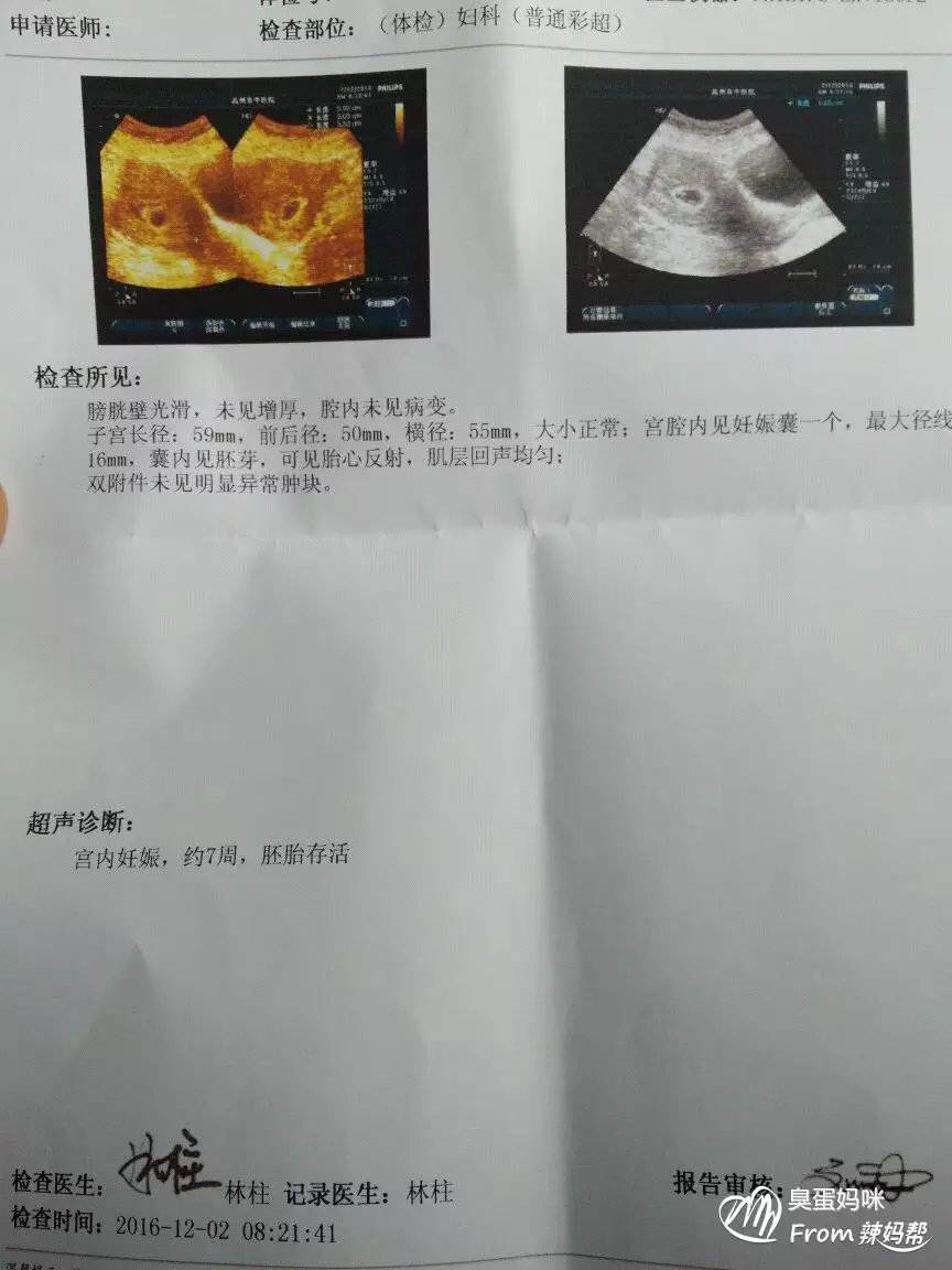 3、成功懷男孩的細節經驗:二胎生男孩的成功經驗是什麼