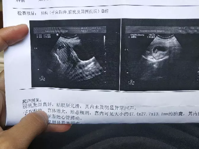懷孕七個月測男女妙招：六個月女翻男的概率是多少