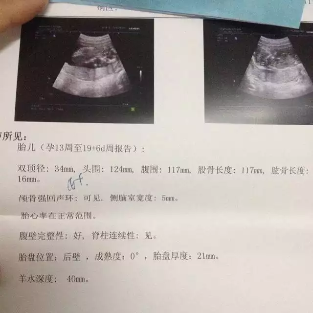 胎心率看男女準不準月份男女男女：胎心看男女大家覺得准嗎