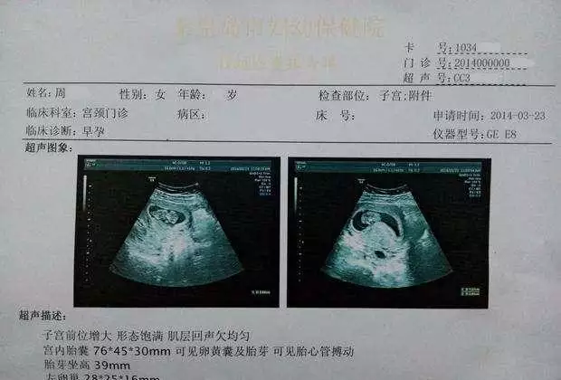 孕囊看男女真的很准嗎：驗證一下，孕囊看男女是否准？