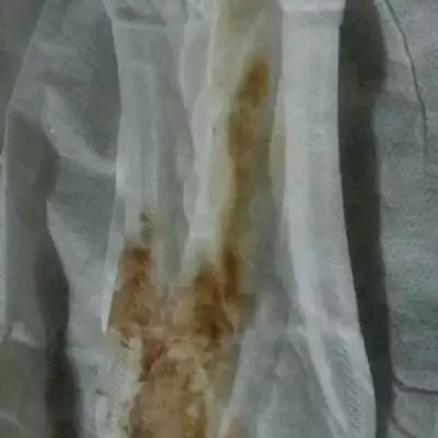 懷孕人是什麼顏色：懷孕后的是什麼顏色